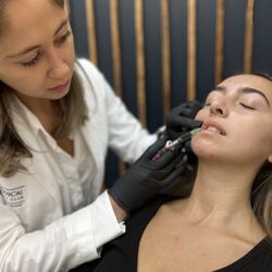 House of Ness: Ness Medical - Lip Augmentation