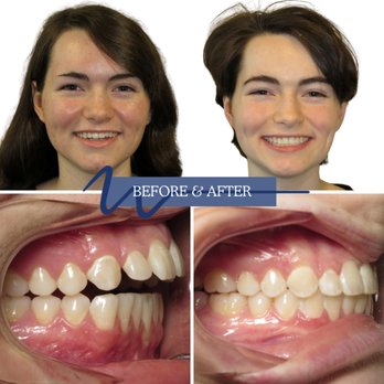 Williamsburg Orthodontics - Orthodontists Near Me - Williamsburg, Virginia Williamsburg Orthodontics - Orthodontists Near Me - Williamsburg, Virginia