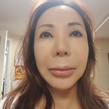 VIP Plastic Surgery - Before surgery - Cosmetic Surgeons Near Me - Los Angeles, California