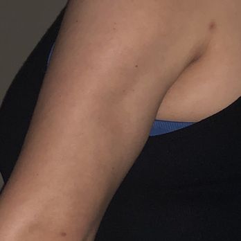Wang Plastic Surgery & Med Spa - Cosmetic Surgeons Near Me - Pasadena, California Wang Plastic Surgery & Med Spa - Cosmetic Surgeons Near Me - Pasadena, California