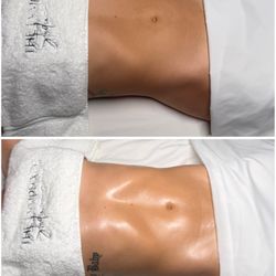 The Lymphatic Studio