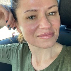 Roma Med Spa - Hydrafacial