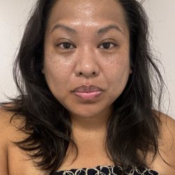 K Beauty Lab - After 2nd session