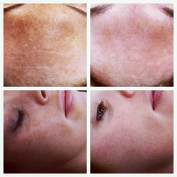 La Bella Derma