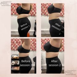 Enhanced Body Studio - Combination of Wood Therapy and Cavitation