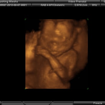 Video Prenatal - Ultrasound Imaging Centers Near Me - Charlotte, North Carolina Video Prenatal - Ultrasound Imaging Centers Near Me - Charlotte, North Carolina