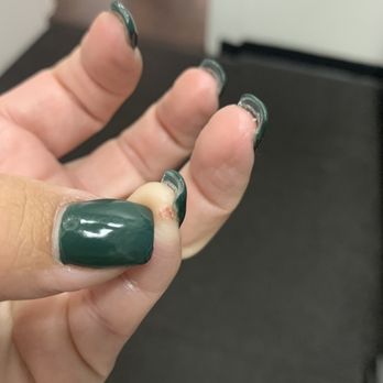 Exotic Nail 4 You - Where he cut or burned me? - Nail Salons Near Me - New Rochelle, New York