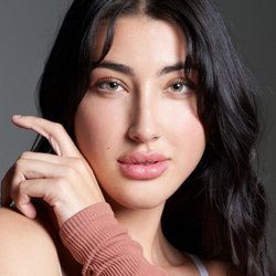 Natural Look Medical Spa - Revanesse Versa Dermal Filler. Susan Coker, PA-C, Expert Aesthetic Injector @naturallookmedicalspa