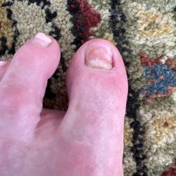 Nail came off after pedicure Turned black immediately after pedicure That night in fact