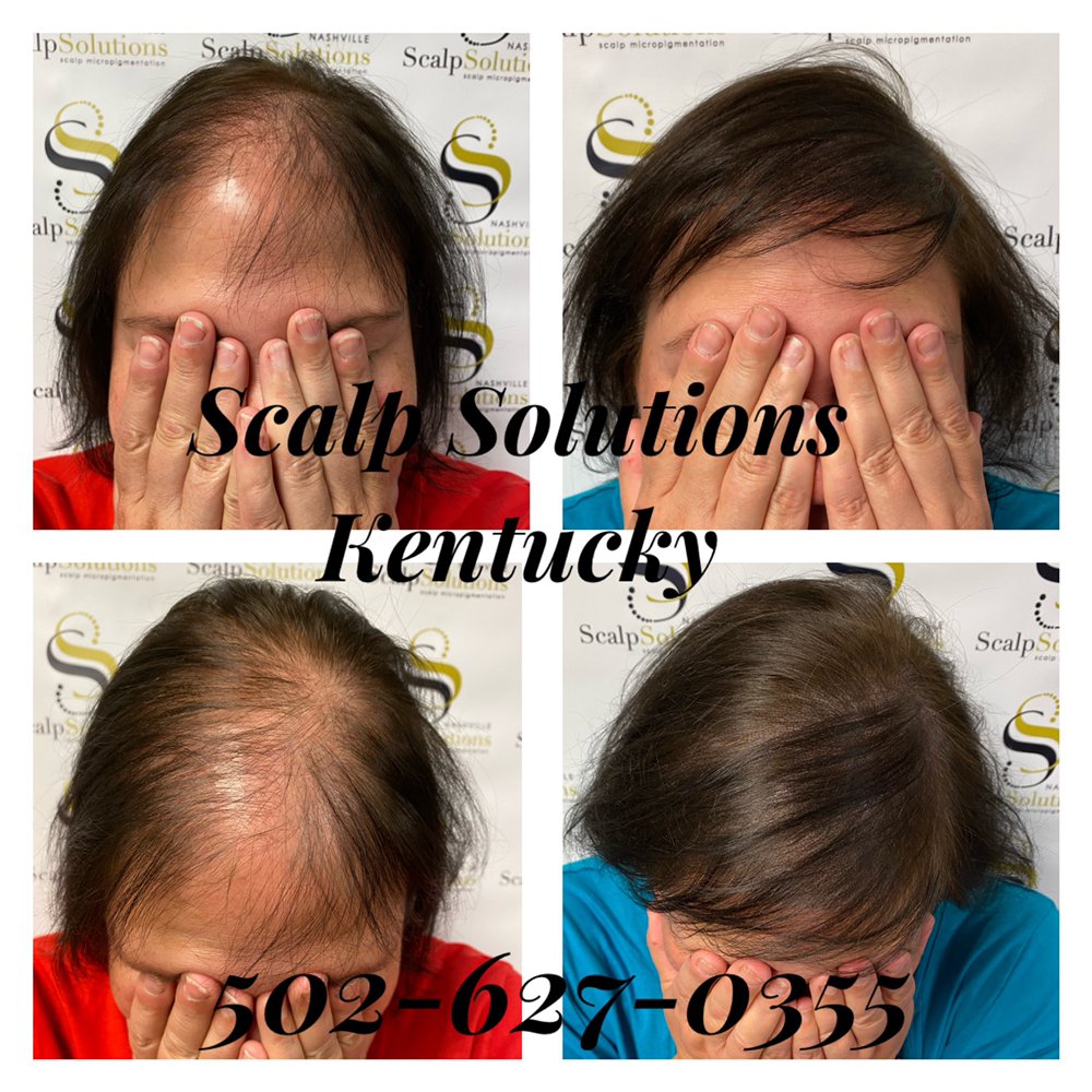 SCALP SOLUTIONS KENTUCKY Updated June 2024 37 Photos 1850 S