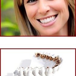 Inna Gellerman, DDS - Incognito invisible braces