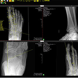 Lower Westchester Foot & Ankle