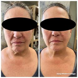Esthetics By Lynn - Consistency pays off