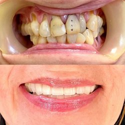 West Coast Dental of North Hills