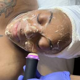 Geneo 3 in 1 Oxy facial