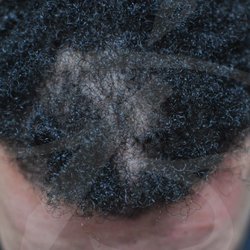 Goddess Brows and Microblading - Before scalp micropigmentation