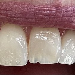 Vera Dooley, DDS - Before repair
