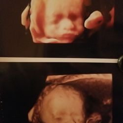 3D 4D Ultrasound Flatirons Prenatal Imaging - It's me I didn't know how to add a picture. Here's Sulie Harlow!!