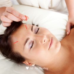 Ali Ali Healing - Facial Rejuvenation Acupuncture