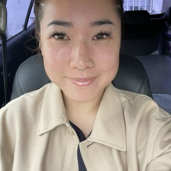 TROIAREUKE California - 3 days after TROIPEEL - Skin Care Near Me - Buena Park, California TROIAREUKE California - 3 days after TROIPEEL - Skin Care Near Me - Buena Park, California