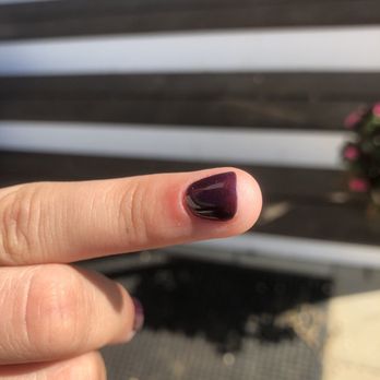 Prestige Nail & Salon - My cuticles is so inflamed! It hurts - Nail Salons Near Me - Trenton, New Jersey Prestige Nail & Salon - My cuticles is so inflamed! It hurts - Nail Salons Near Me - Trenton, New Jersey