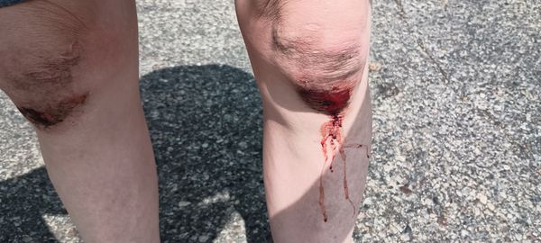 Abbott Northwestern Hospital by null