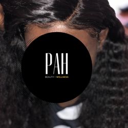 Posh Avenue Hair - Cranial Prostheses Unit Install for Alopecia Areata.