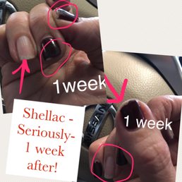 Horrible! Shellac literally started lifting & peeling 2 days after having them done. Horrible! Shellac literally started lifting & peeling 2 days after having them done.
