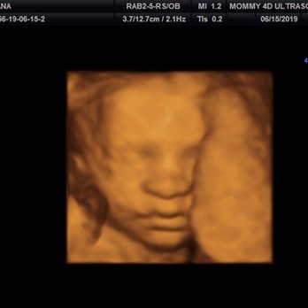 Babes & Bellies - My baby boy Maddox. - Ultrasound Imaging Centers Near Me - Long Beach, California
