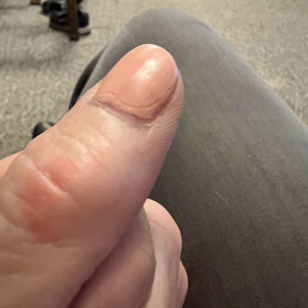 You can see where the top coat ends and the bumps in the polish You can see where the top coat ends and the bumps in the polish