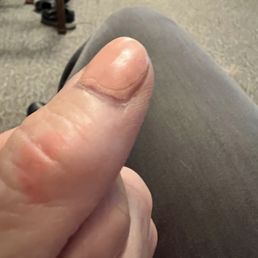 You can see where the top coat ends and the bumps in the polish You can see where the top coat ends and the bumps in the polish