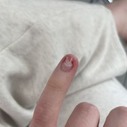 Flip Flops Nails & Spa - This is her nail being ripped off