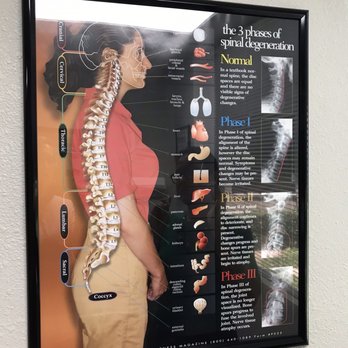 Intouch Chiropractic - Neck chart - Chiropractors Near Me - San Diego, California