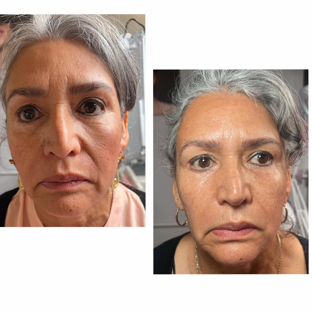 Novo Skincare