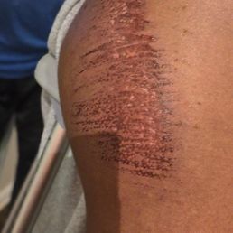 Some of my visible injury's my head and shoulder which were most damaged Some of my visible injury's my head and shoulder which were most damaged