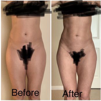 Ashkan Ghavami, MD - Plastic Surgeons Near Me - Beverly Hills, California