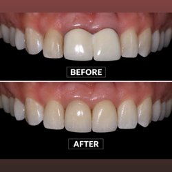 Encino Dental Studio-Amir Jamsheed, DDS