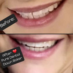 Pure Dental, Dawn C. Baker