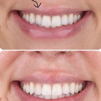 Livewell Dental - Cosmetic Dentists Near Me - Fairfax Station, Virginia Livewell Dental - Cosmetic Dentists Near Me - Fairfax Station, Virginia