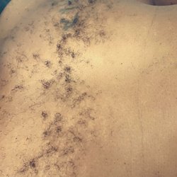 Revive Skin Spa - Before