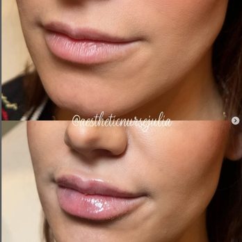 Meesha Aesthetics - Medical Spas Near Me - Allentown, Pennsylvania Meesha Aesthetics - Medical Spas Near Me - Allentown, Pennsylvania