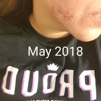Lindy’s Skin Studio - Skin Care Near Me
