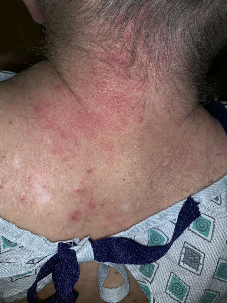 FAIRFIELD NURSING & REHABILITATION CENTER 20 Photos & 14 Reviews