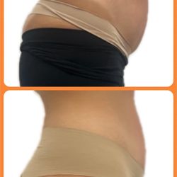Contour Room - Exion RF/US