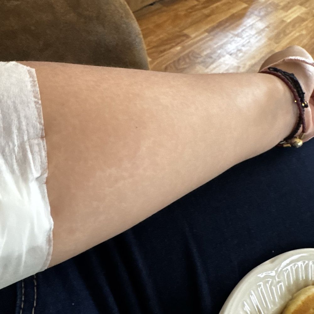 Quest Diagnostics - my arm got swollen and hurt so much? - Laboratory Testing Near Me - Houston, Texas Quest Diagnostics - my arm got swollen and hurt so much? - Laboratory Testing Near Me - Houston, Texas