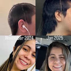 Vanity Lane Beauty Bar - Hair transformation using K-tips after brain surgery where I had to have had half my head shaved