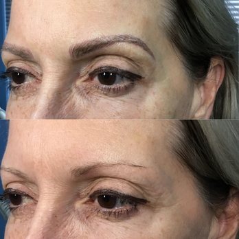Kefi Aesthetics - microblading - Waxing Near Me - Avon, Connecticut Kefi Aesthetics - microblading - Waxing Near Me - Avon, Connecticut