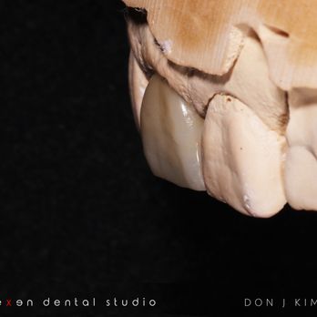 Nexen Dental Studio - Cosmetic Dentists Near Me - Huntington Beach, California Nexen Dental Studio - Cosmetic Dentists Near Me - Huntington Beach, California