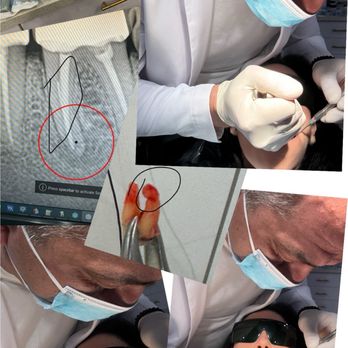 Elite Dental Group - Pain free - Cosmetic Dentists Near Me - Glendale, California Elite Dental Group - Pain free - Cosmetic Dentists Near Me - Glendale, California
