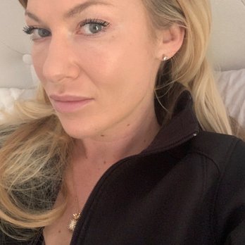Alladerm Medical Spa - After photo - Medical Spas Near Me - Aliso Viejo, California